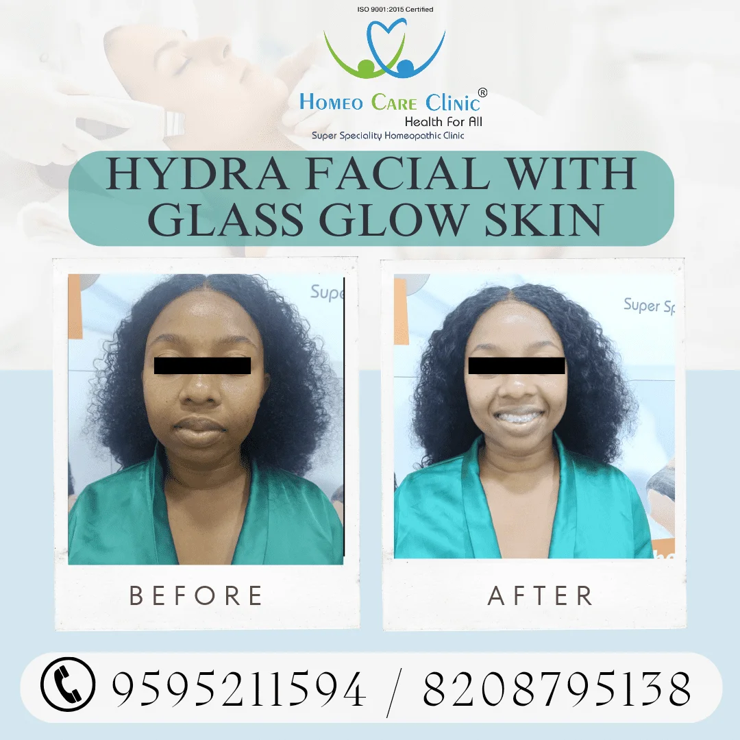 Hydra-Facial-with-Glass-Glow